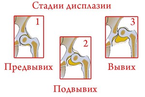 Дисплазия  в  суставах собак